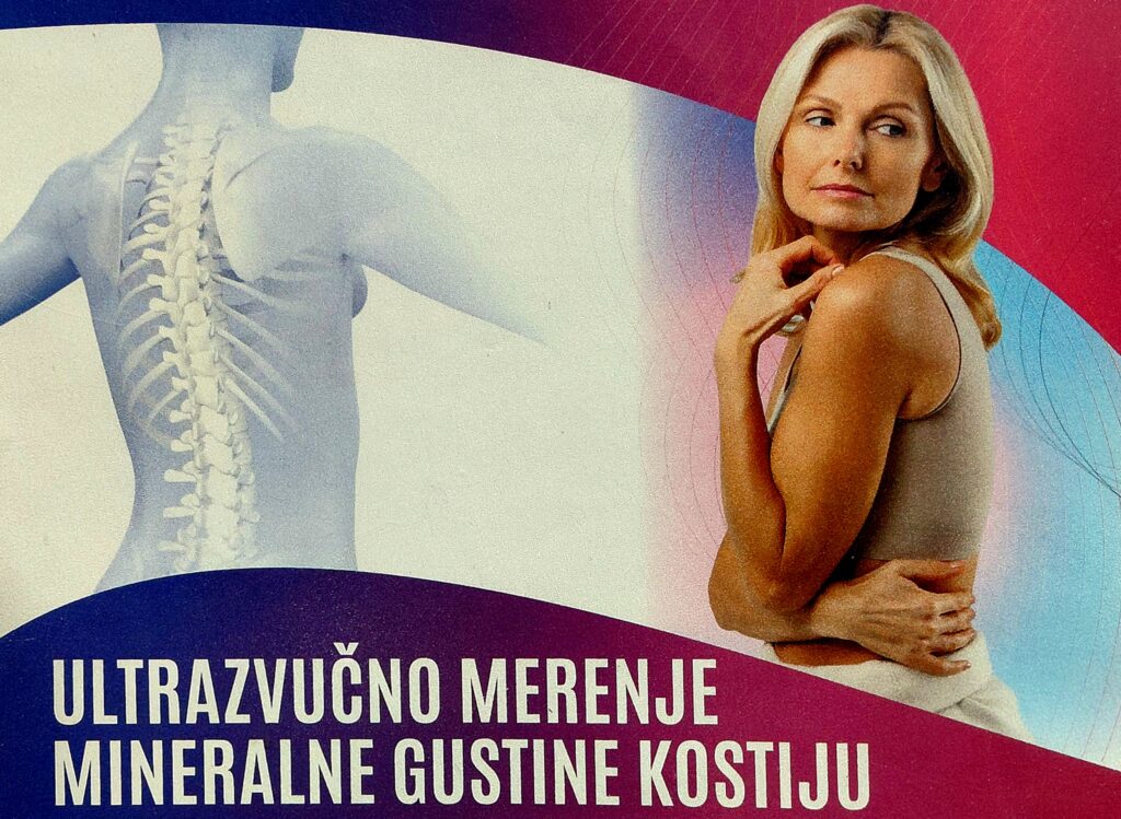 Sprečite osteoporozu na vreme