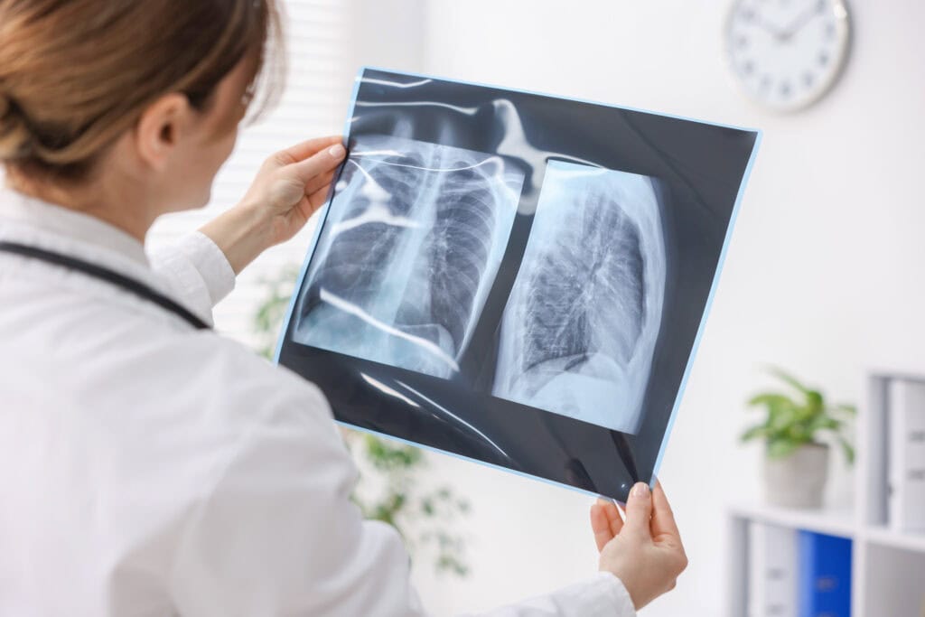 Lekar pregledava rentgen pluća u medicinskoj ordinaciji.